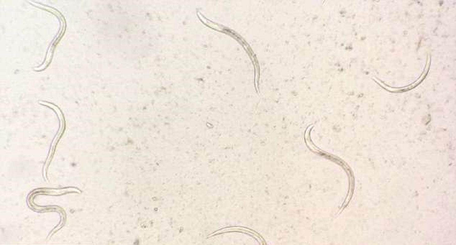 Стронгилоидоз - черви-паразиты под кожей.