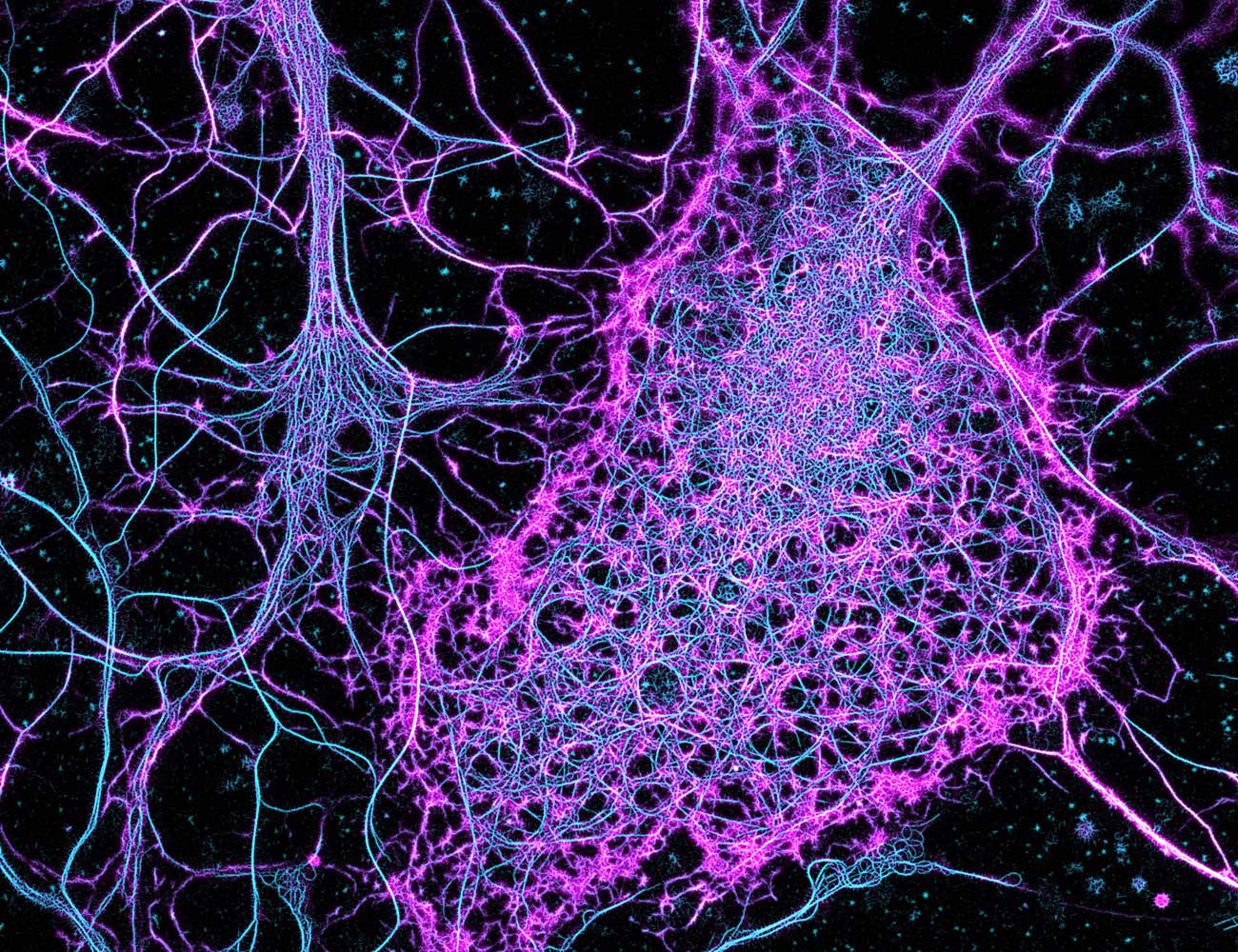 Нейросекреторная клетка гистология