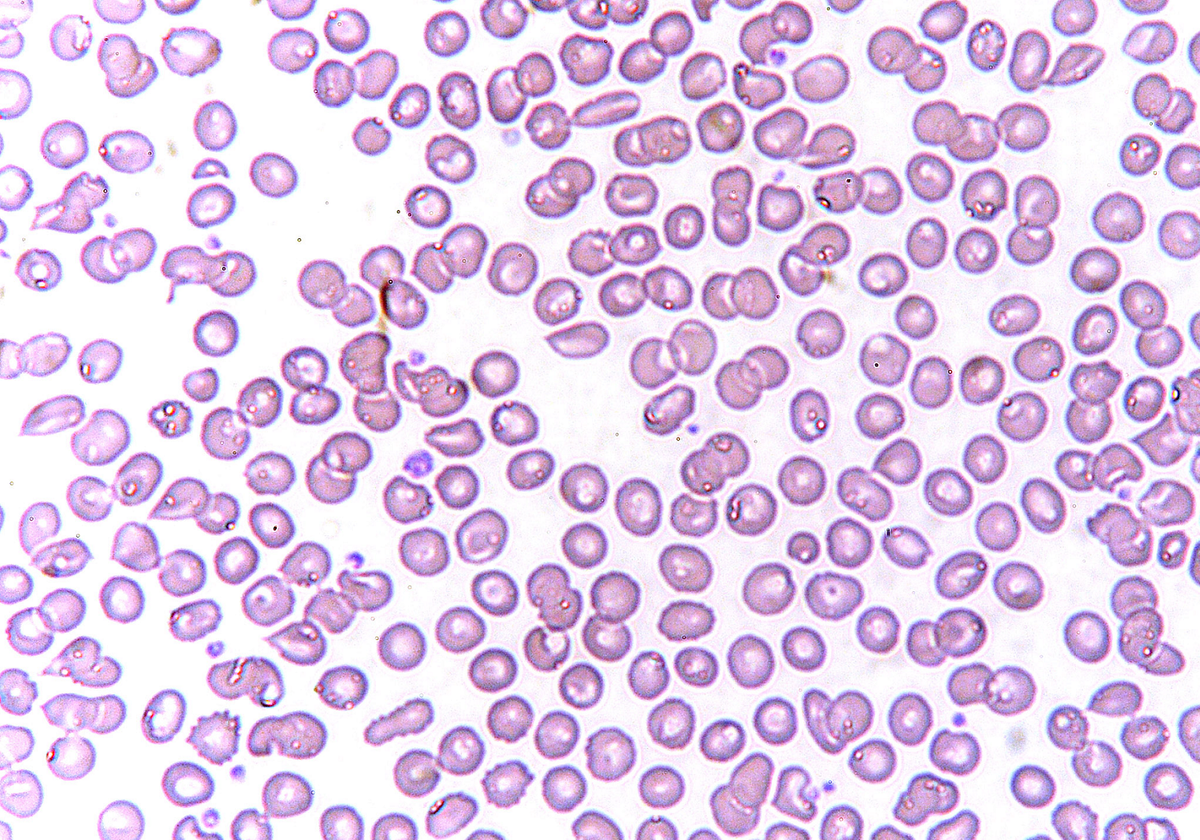 Эритроциты в крови микроскопия