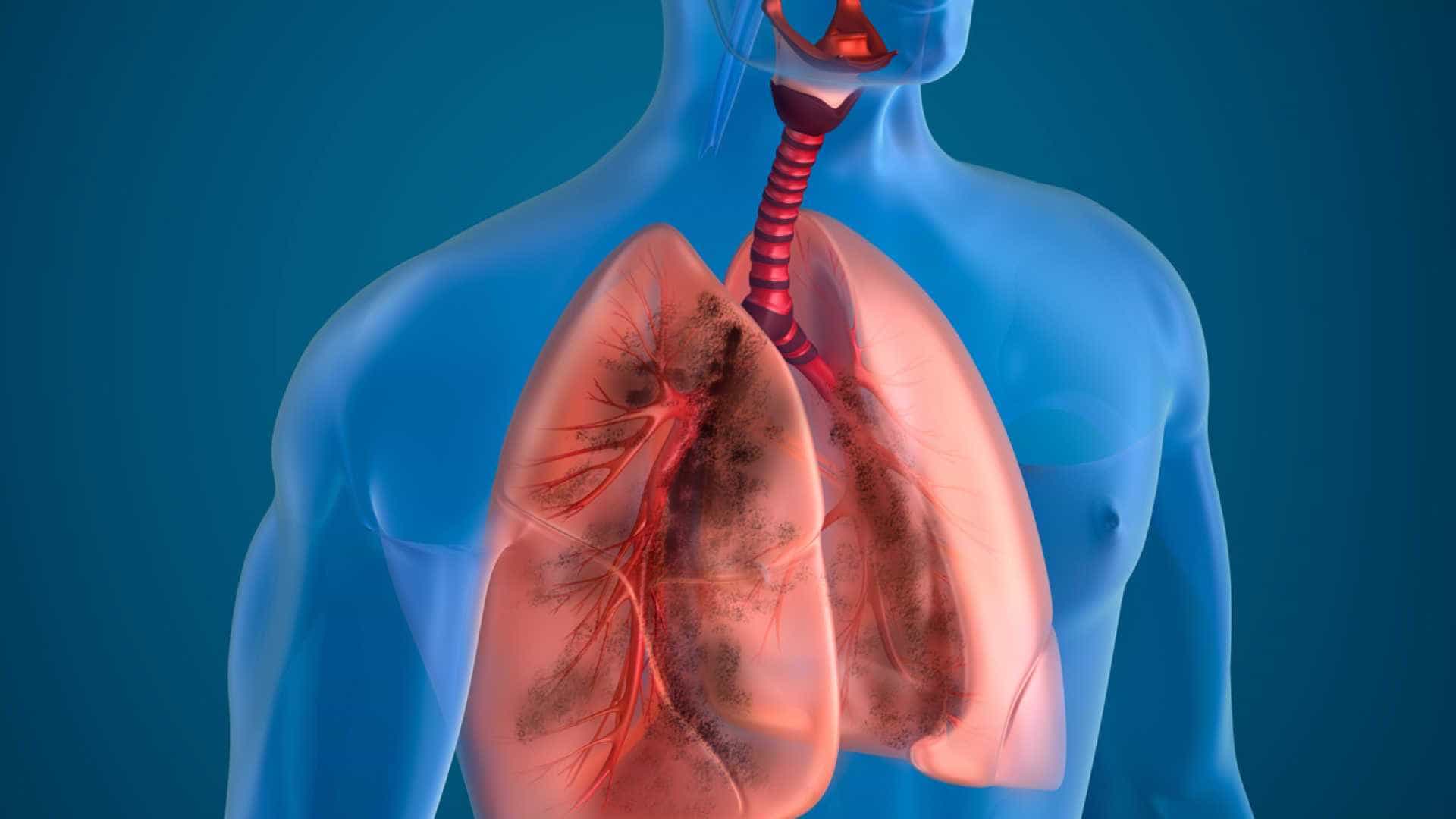 Поражение легких лечение. Патология органов дыхания. Поражение органов дыхания.