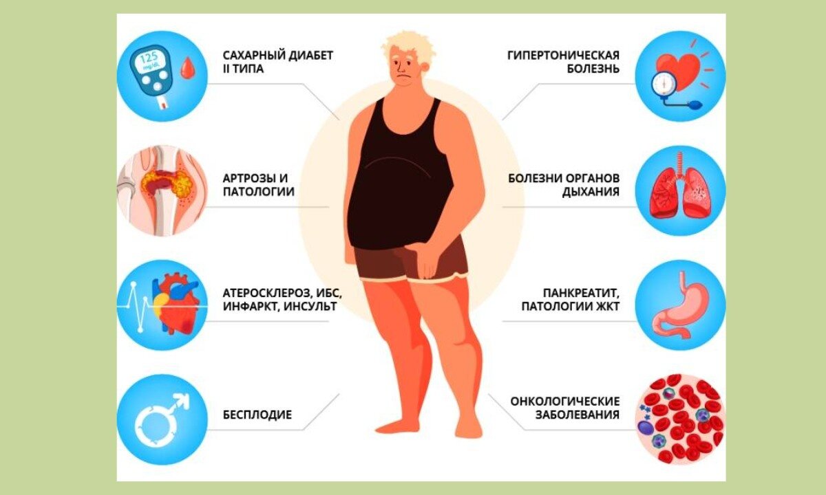 Ожирение фактор риска развития заболеваний