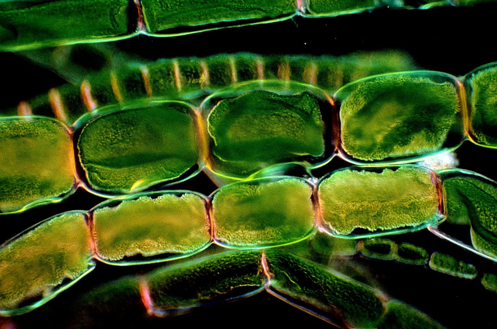 Хлоропласты в клетках листьев крупные. Хлорофилл под микроскопом. Хлоропласт под микроскопом. Фитопланктон хлоропласты. Элодея фотосинтез.