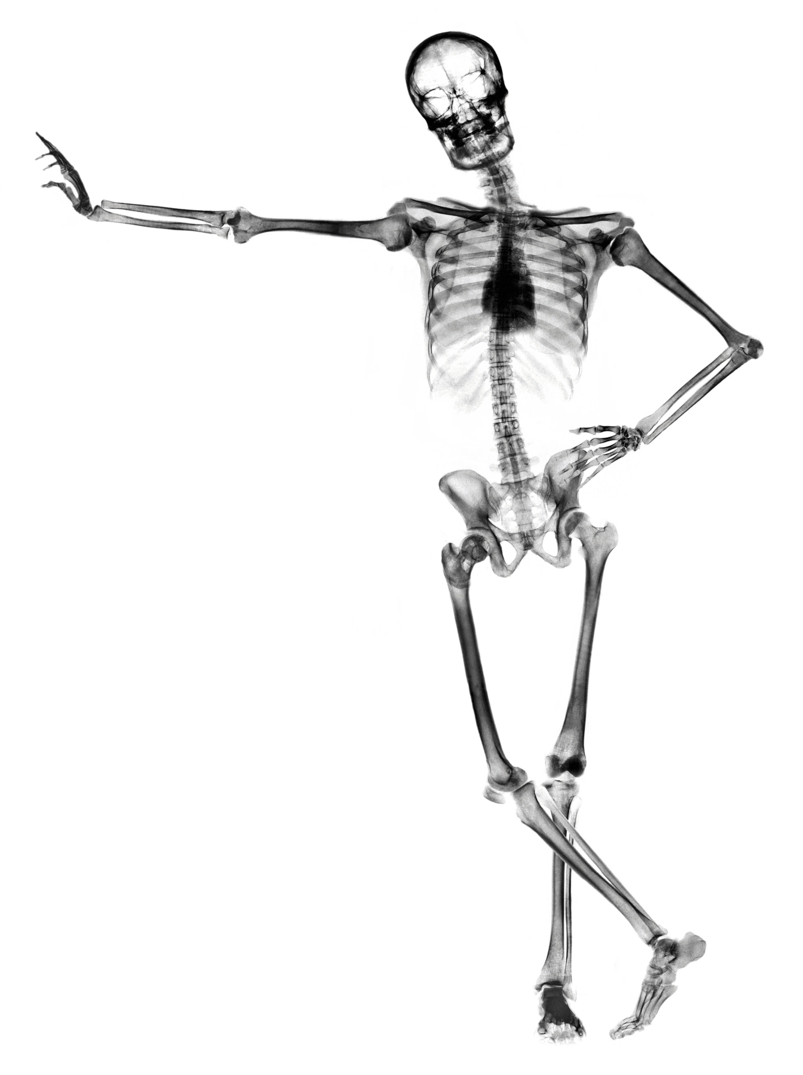 Снимок скелета